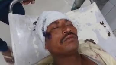 मुरादाबाद: भोजपुर थाना क्षेत्र में शराब के नशे में व्यक्ति बाइक से गिरकर हुआ घायल, इलाज जारी