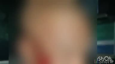 ब्यौहारी: ब्यौहारी थाना क्षेत्र के शहडोल रीवा मार्ग में सड़क में बैठे मवेशी से टकराई बाइक  तीन लोग हुए घायल मवेशी की मौत