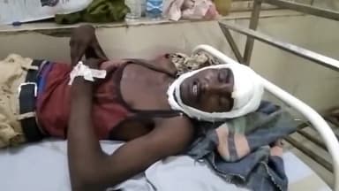 गुना नगर: अकोदा गांव में चार लोगों ने बकरा देने से मना करने पर चाचा-भतीजे को मारपीट कर किया घायल, इलाज जारी