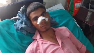 रामपुर: थाना मिलक क्षेत्र के पूरेनीया के पास दो मोटरसाइकिलों की टक्कर में दो लोग हुए घायल जिला अस्पताल में भर्ती