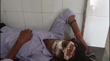 टीकमगढ़: कुडियाला गांव में बाइक अनियंत्रित होने के कारण चालक हुआ घायल, जिला अस्पताल में किया गया भर्ती