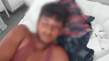 रामपुर: थाना भोट क्षेत्र के टोल टैक्स नर्सरी के पास मारुति कार और मोटरसाइकिल की टक्कर में दो मोटरसाइकिल सवार हुए घायल