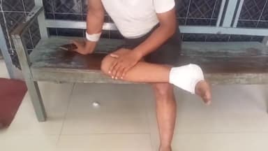 एकंगरसराय: मानपुर गांव के पास बाइक दुर्घटना में बाइक सवार हुआ जख्मी