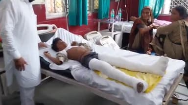 रामपुर: मिलक में बस हादसे में घायल 32 लोगों का जिला अस्पताल में इलाज जारी, हाल जानने पहुंचे वीर खालसा सेवा समिति के जिलाध्यक्ष