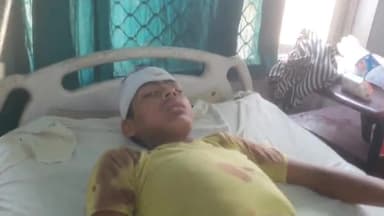 रामपुर: तारका मझरा गांव में मामूली सी बात को लेकर एक महिला ने किशोर के सिर में ईंट मारकर किशोर को किया घायल,अस्पताल में भर्ती