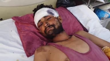 रामपुर: ग्राम बरा मिलक में दो बाइक की टक्कर में एक युवक हुआ घायल, उपचार जारी