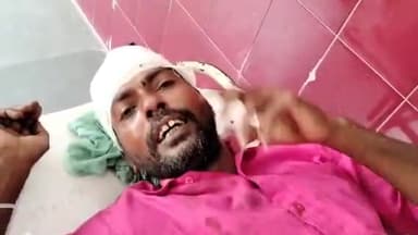 मुरादाबाद: बिलारी थाना क्षेत्र में बच्चे बच्चे मे हुआ विवाद के बाद, 6 से 7 लोगो ने की व्यक्ति के साथ मारपीट