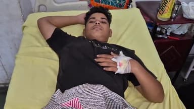 रामपुर: थाना अजीम नगर क्षेत्र के खंडिया चौराहे के पास मोटरसाइकिल के सामने कुत्ता आने से एक व्यक्ति गिरकर हुआ घायल