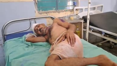 बुलंदशहर: गांव शाहपुर कला में बिजली का तार डालने को लेकर हुए विवाद में दबंग पड़ोसी ने पिता पुत्र को  मारपीट कर किया घायल