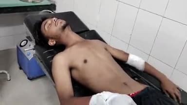 मुरादाबाद: मझोला थाना क्षेत्र में चलती बाइक के आगे अचानक कुत्ता आ जाने से, दो बाइक सवार युवक गिरकर हुआ घायल