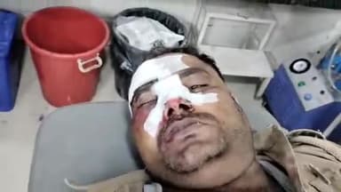 मुरादाबाद: थाना सोनकपुर इलाके के इब्राहिमपुर में एक हेड कांस्टेबल को तेज रफ्तार बाइक ने पीछे से टक्कर मार दी, इलाज के लिए भर्ती