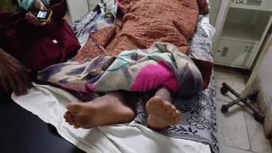 सिमडेगा: किनकेल में जहरीले सांप के काटने से एक व्यक्ति की बिगड़ी हालत