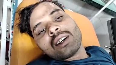 मुरादाबाद: भगतपुर थाना क्षेत्र में तेज रफ़्तार कार ने सामने से बाइक मे टक्कर, तीन लोग गिरकर गंभीर रूप से घायल