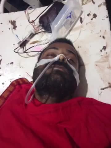 उदवंत नगर: उदवंतनगर बाजार में अपराधियों ने एक युवक को मारी गोली, निजी क्लिनिक में इलाज जारी