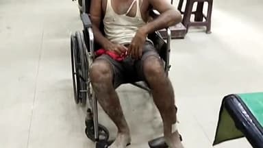 समस्तीपुर: गोरगामा गांव में घर में शराब नहीं रखने दिया तो एक ही परिवार के तीन सदस्यों के साथ की गई मारपीट