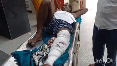 हरदोई: पुरानी रंजिश में पाली कस्बा निवासी एक युवक के ऊपर गांव के ही एक युवक ने चढ़ाई मोपेड, युवक हुआ गंभीर घायल