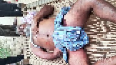 विष्णुगढ़: विष्णुगढ़ के चितरामो जंगल में हाथियों के झुंड से कुचलकर घायल हुए बुजुर्ग की इलाज के दौरान हुई मौत, गांव में शोक का माहौल