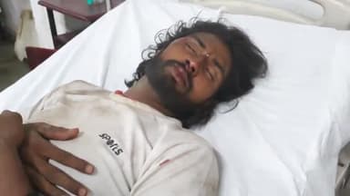 रामपुर: मूढापांडे के पास एक तेज रफ्तार बाइक सवार ने दो कांवड़ियों को मारी टक्कर पांच घायल तीन रामपुर में दो मुरादाबाद रैफर