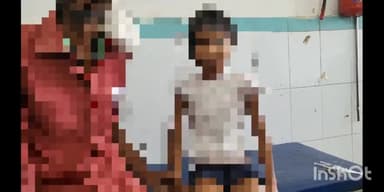 सुपौल: लोकहा में गर्म चाय शरीर पर गिरने से 7 वर्षीय लड़की झुलसी, सदर अस्पताल सुपौल में इलाज जारी