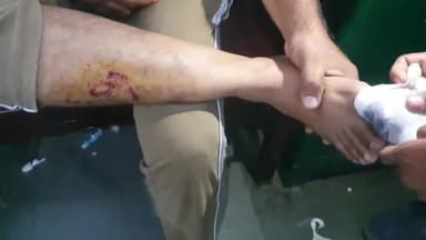 रामपुर: मोरी गेट के पास एक तेज़ रफ़्तार ई रिक्शा चालक ने बाइक सवार युवक को मारी टक्कर, बाइक सवार युवक के पैर में लगी गंभीर चोट