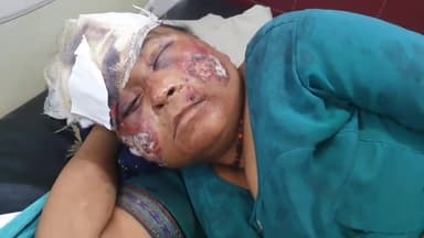 रामपुर: पदमपुर गांव की बुजुर्ग महिला को मामूली सी बात को लेकर उसके बेटे ने थप्पड़ और डंडों से पीटकर किया घायल अस्पताल में भर्ती