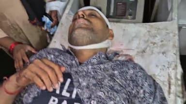 रामपुर: थाना बिलासपुर क्षेत्र के ध्वनि के पास ट्राली और मोटरसाइकिल की टक्कर में मोटरसाइकिल सवार घायल जिला अस्पताल में भर्ती