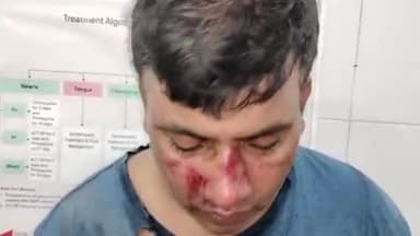 मुरादाबाद: कटघर थाना क्षेत्र में अज्ञात कारणों  के चलते मोबाइल पर बात कर रहे व्यक्ति के साथ, चार से पांच युवकों ने की जमकर मारपीट