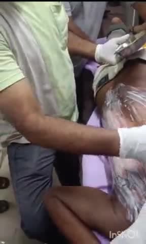 औरैया: कोतवाली क्षेत्र के खिड़की साहबराय निवासी युवक ने भाई एवं भाभी पर खोलता हुआ पानी डालने का लगाया आरोप, पुलिस से शिकायत