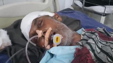 रामपुर: शाहाबाद: पंजाबनगर शिव मंदिर के पास अज्ञात बाइक सवार ने साइकिल सवार व्यक्ति को मारी टक्कर साइकिल सवार व्यक्ति गंभीर रूप से घायल