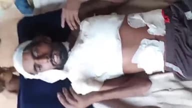 कैराना: मोहल्ला दरबारखुर्द रेतावाला निवासी मजदूर को ईंट मारकर किया गया घायल, पीड़ित की पत्नी ने कोतवाली में दी तहरीर