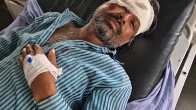 रामपुर: थाना बिलासपुर क्षेत्र के ईदगाह के पास दो मोटरसाइकिलों की टक्कर में दो लोग हुए घायल जिला अस्पताल में भर्ती