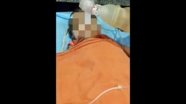 वाराणसी में छज्जा गिरने से घायल बच्ची की मौत BHU ट्रामा सेंटर में चल रहा था इलाज