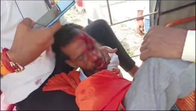 नुआंव: अकोल्हि काली मंदिर के समीप बाइक के अनियंत्रित होकर पलटने से बाइक सवार पिता पुत्र गंभीर रूप से हुए घायल