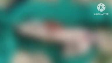 इंद्रगढ़: चाकन नदी में एक सप्ताह पुराना एक व्यक्ति का मिला शव, पुलिस ने मेडिकल बोर्ड से पोस्टमार्टम करवाकर किया अंतिम संस्कार