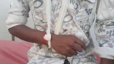 रामपुर: चाकू चौराहे के पास 2 बाइकों की आमने-सामने हुई टक्कर, 2 लोग हुए घायल