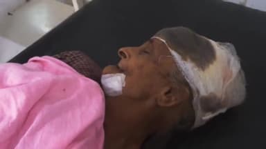 रामपुर: आदर्श कॉलोनी में  जमीनी  विवाद को लेकर एक बेटा ने अपनी बुज़ुर्ग मां को पीटकर घायल कर दिया, बुजुर्ग मां अस्पताल में भर्ती