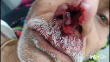 बाह: पिनाहट में जंगली जानवर का हमला भेड़िये ने आधा दर्जन से अधिक ग्रामीणों को किया घायल