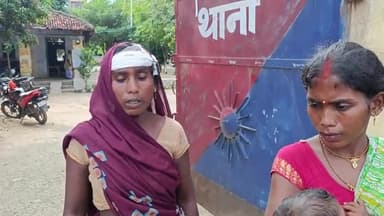 घोसी: गोड़सर गांव में आपसी विवाद को लेकर हुई मारपीट में एक महिला हुई जख्मी, पहुंची घोड़ी थाने