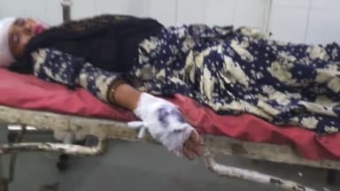 रामपुर: शंकरपुर के पास  एक बाइक सवार दंपति को एक दूसरे बाइक सवार युवक ने टक्कर मारी,दंपति घायल अस्पताल में भर्ती