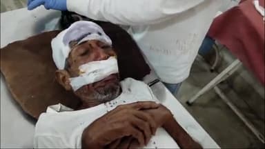 पीरटांड: पीरटांड के पालगंज निवासी 70 वर्षीय बढ़न सोनार को कुत्ते ने काटकर किया जख्मी, सदर अस्पताल में चल रहा इलाज