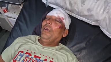 रामपुर: अजीम नगर थाना क्षेत्र में जौहर यूनिवर्सिटी के पास अज्ञात वाहन ने मोटरसाइकिल सवार को मारी टक्कर, मोटरसाइकिल सवार हुआ घायल