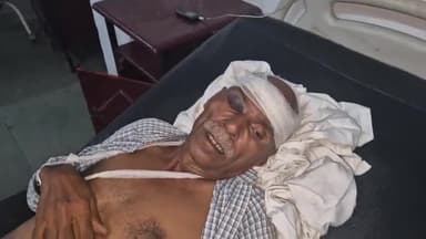 रामपुर: थाना शाबाद क्षेत्र के गुजरेला के पास साइकिल सवार को मोटरसाइकिल ने मारी टक्कर, साइकिल सवार घायल