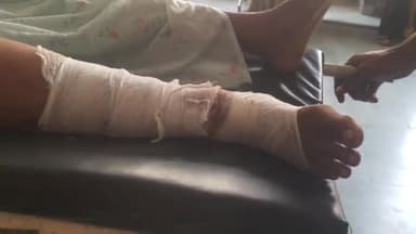 रामपुर: चाकू चौराहे के पास अज्ञात बाइक सवार ने दूसरे बाइक सवार को मारी टक्कर, बाइक के पीछे बैठी महिला घायल