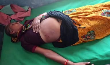 लंभुआ: हरिहरपुर सहनिवा में भेड़िया के आतंक से महिला समेत तीन लोग घायल, इलाज जारी
