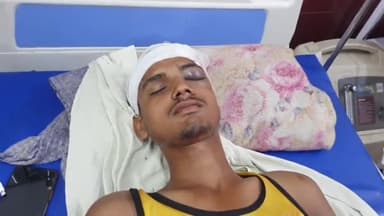 रामपुर: ग्राम पसियापुरा बाईपास पर मोटरसाइकिल फिसलने से दो युवक घायल, ज़िला अस्पताल में भर्ती