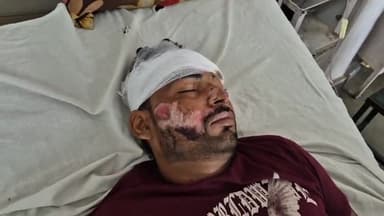 रामपुर: भोट थाना क्षेत्र के कोली कोयला टोल टैक्स के पास बाइक के सामने कुत्ता आने से बाइक गिरी, एक व्यक्ति घायल हुआ