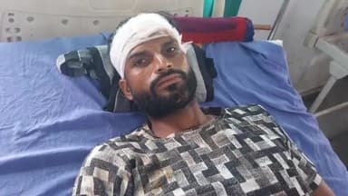 रामपुर: शाहबाद ब्लॉक के सामने ट्रक की टक्कर से एक व्यक्ति घायल, ज़िला अस्पताल में भर्ती