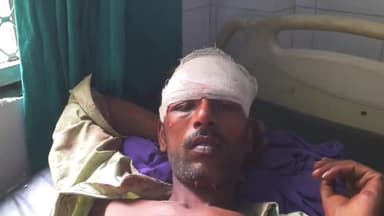 रामपुर: चमरपुरा चौराहे के पास अज्ञात कार चालक ने पैदल जा रहे युवक को मारी टक्कर, युवक गंभीर रूप से घायल