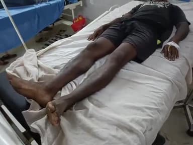 सिमडेगा: कर्राडोमैर में जहरीले सांप के काटने से एक व्यक्ति की हालत हुई गंभीर