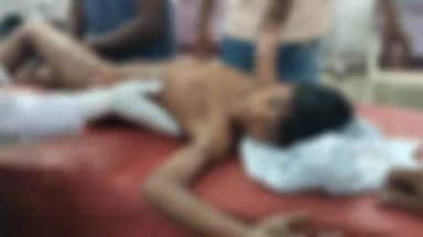 बिजनौर: बिजनौर के कोहल्ला काजीपाड़ा में 5 वर्षीय बालक गर्म दूध पर गिरकर बुरी तरह झुलस गया